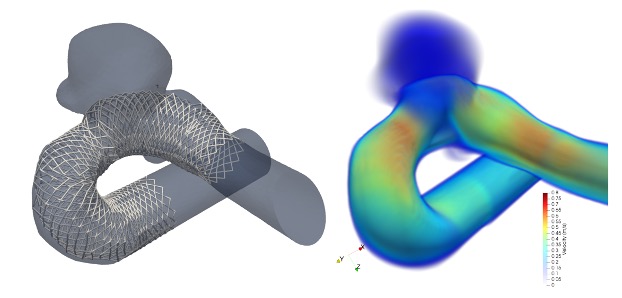 Stented CFD